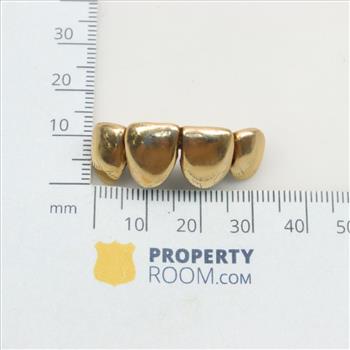 10kt Gold Teeth Cover