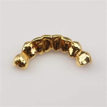 14kt Gold Teeth Caps