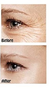 retinol pro plumping eye contour