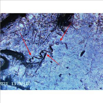 MINT ERROR*1881-S Morgan Silver Dollar*Lamination Error